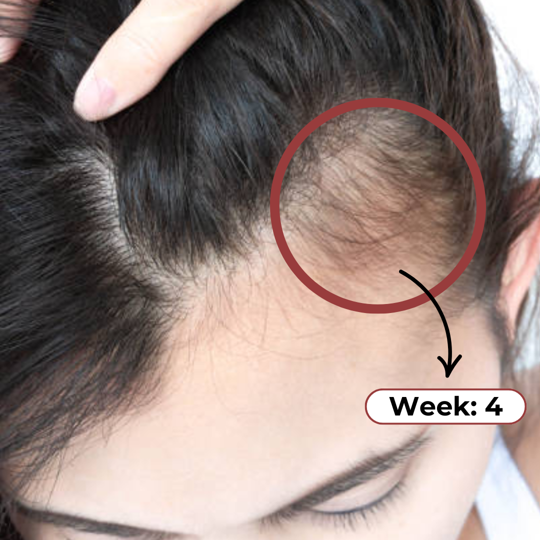 Celure Growth Gummies