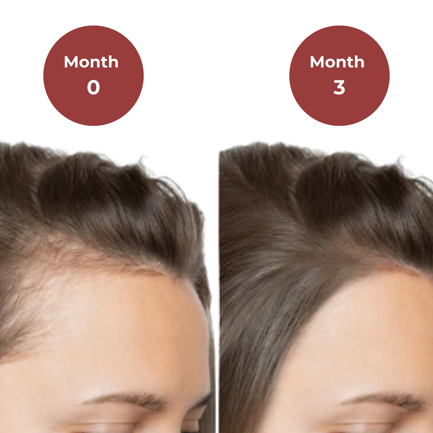 Celure Growth Gummies