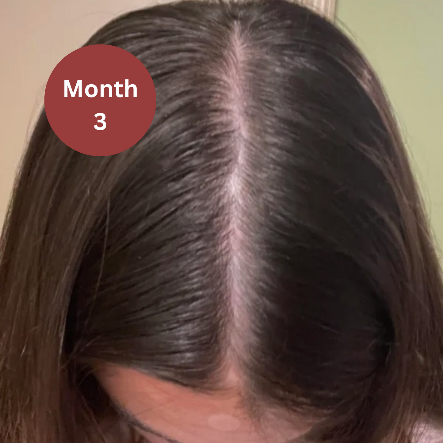 Celure Growth Gummies